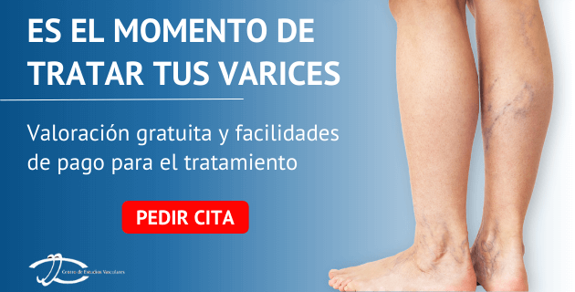 total Notable Centro comercial Formas de desinflamar venas de las piernas | Centro Estudios Vasculares