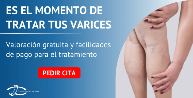 pedir cita varices