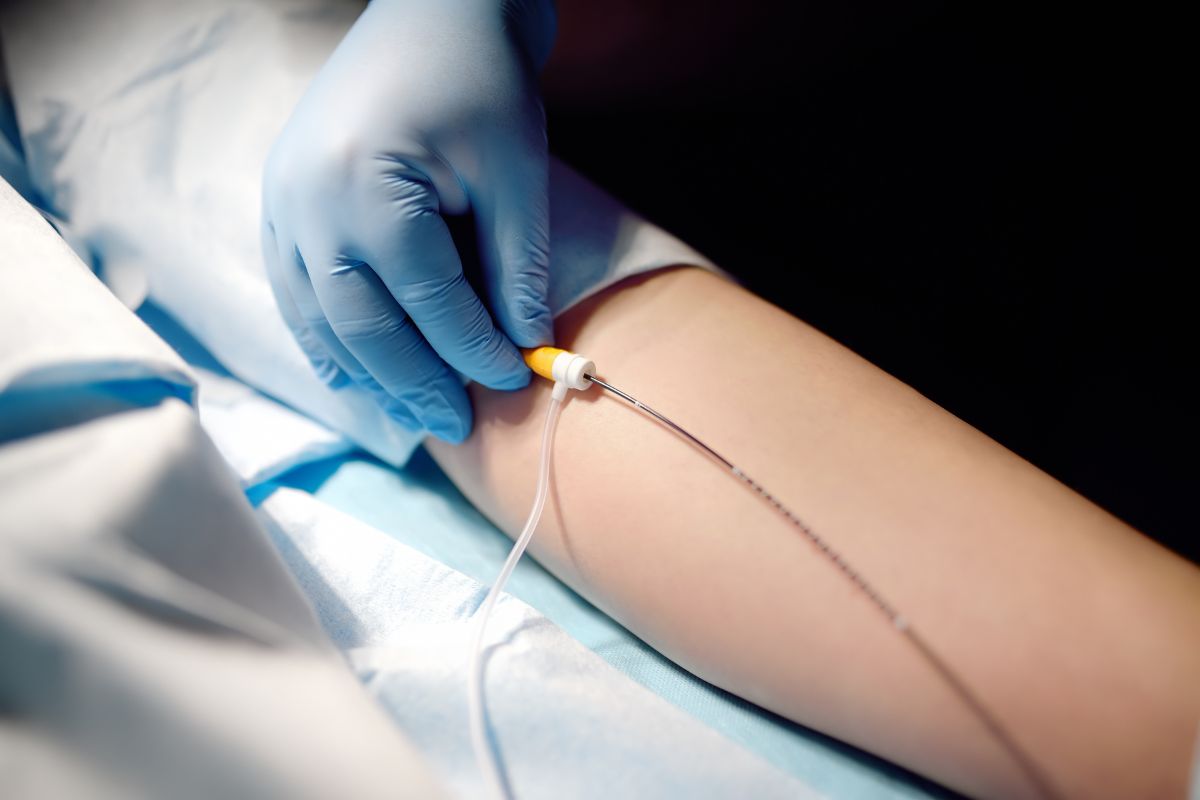 alternativas a la laserterapia vascular